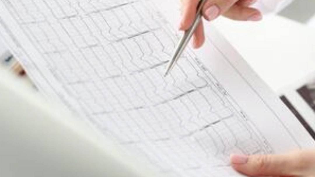 Analyse du Rythme cardiaque fœtal et application en salle de naissance